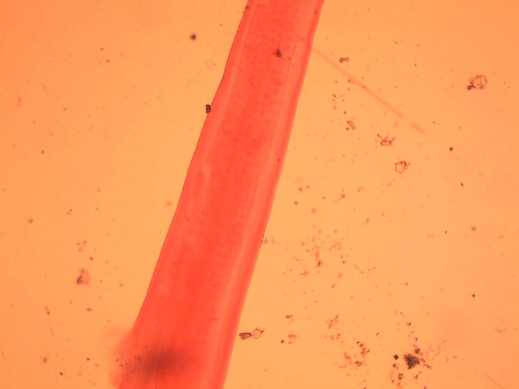 Image of Pinworm