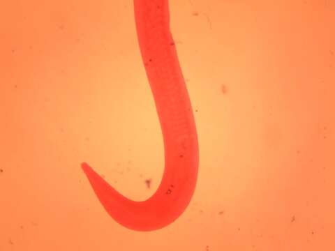 Image of Pinworm