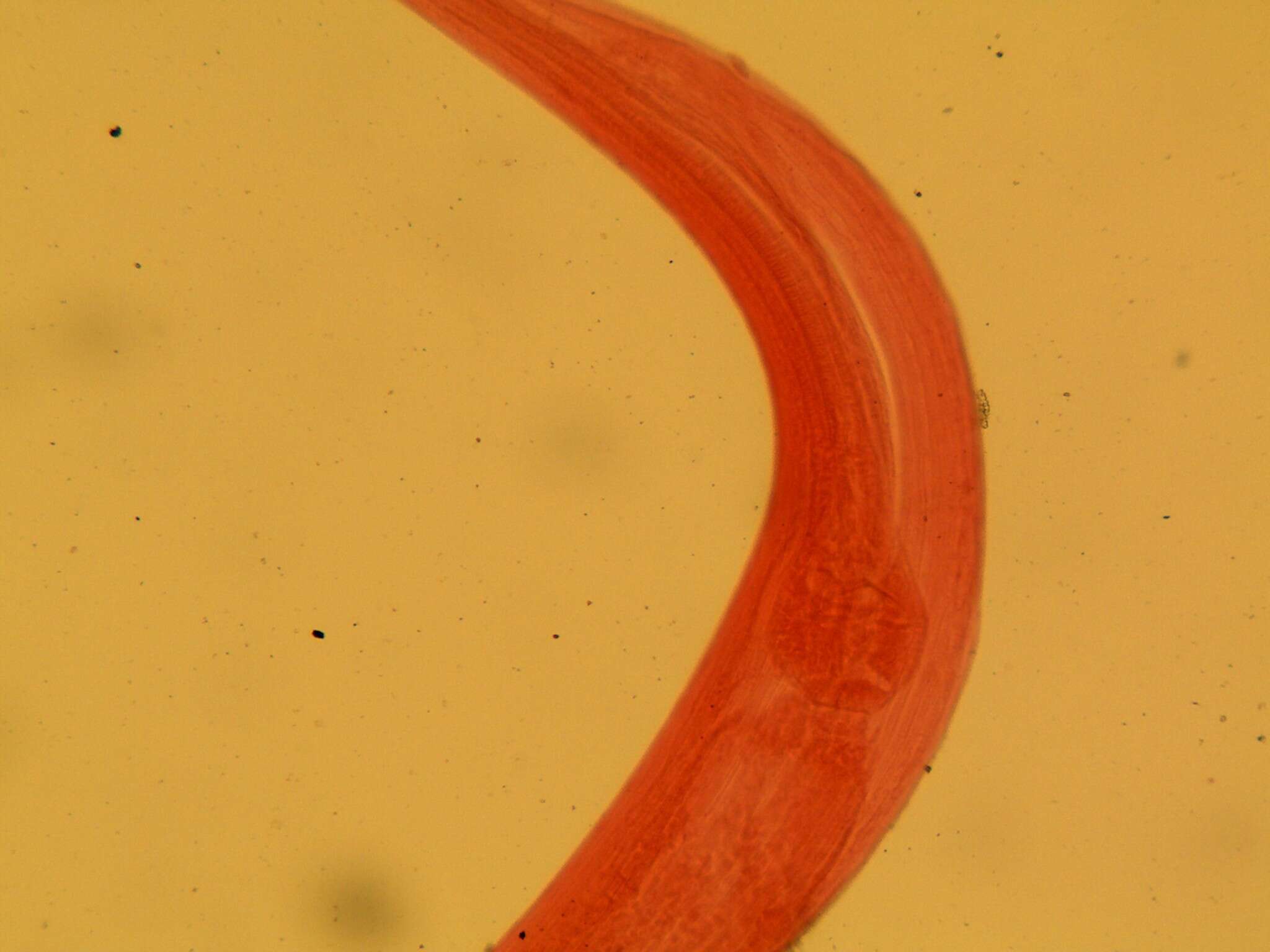 Image of Pinworm