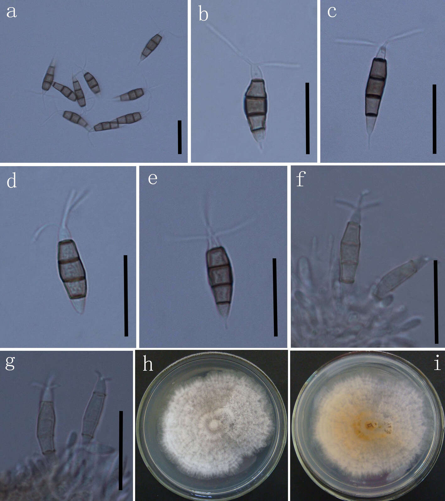 Image of Pestalotiopsidaceae