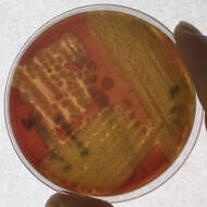 Image of Bacillus cereus