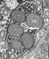 Imagem de Convolutidae