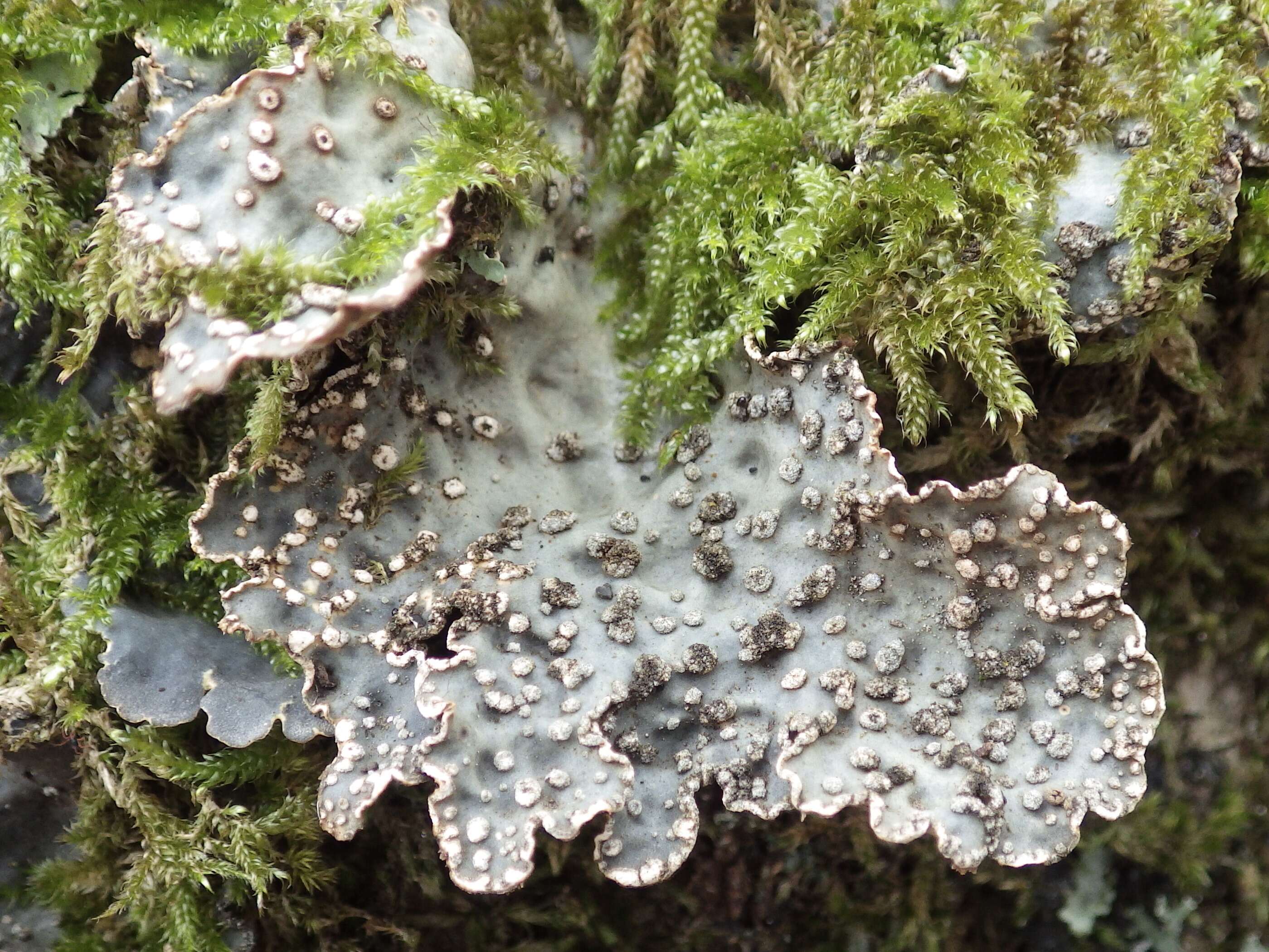 Image of lung lichen