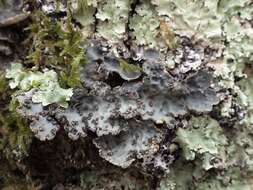 Image of lung lichen