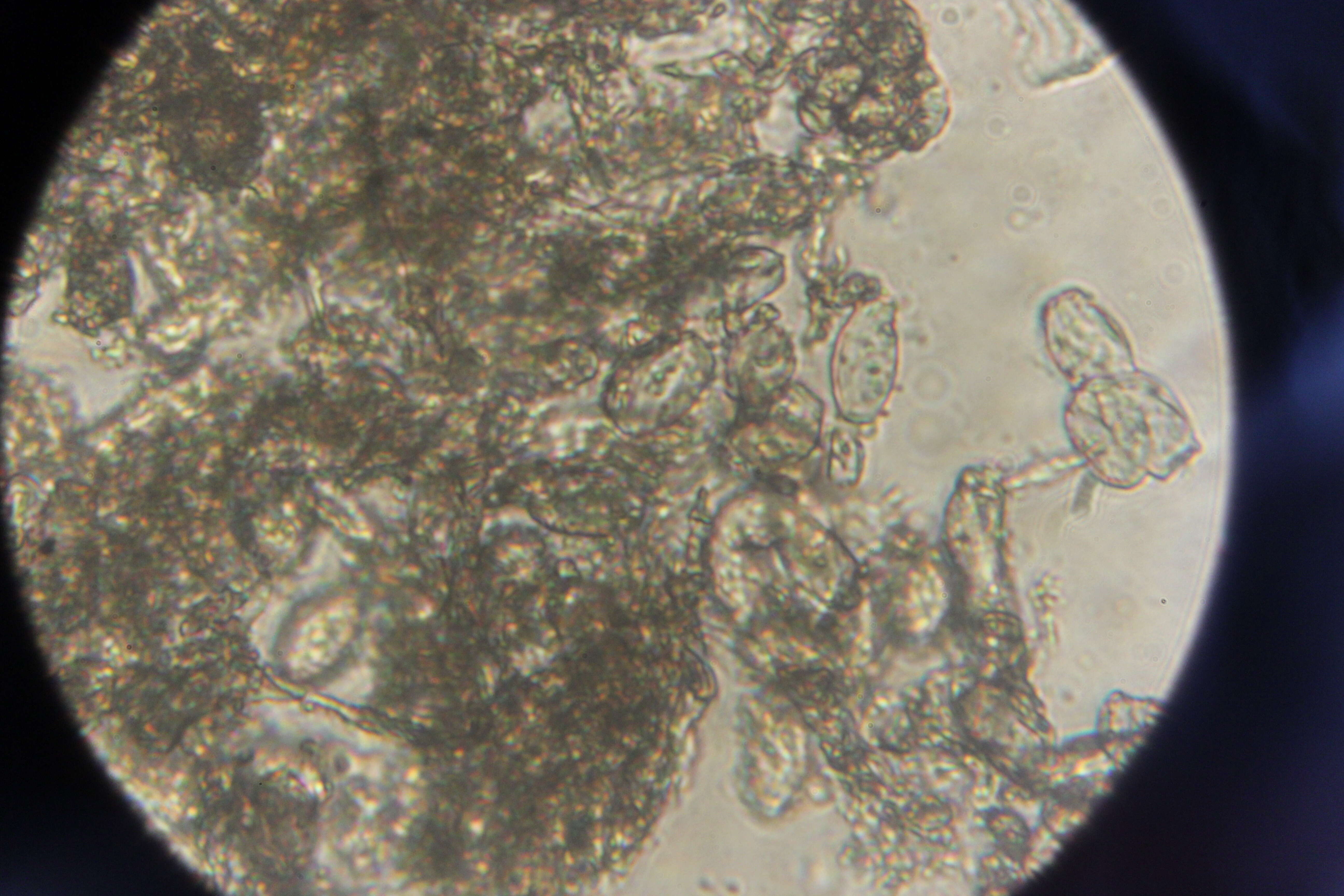 Podosphaera filipendulae (Z. Y. Zhao) T. Z. Liu & U. Braun 2010的圖片