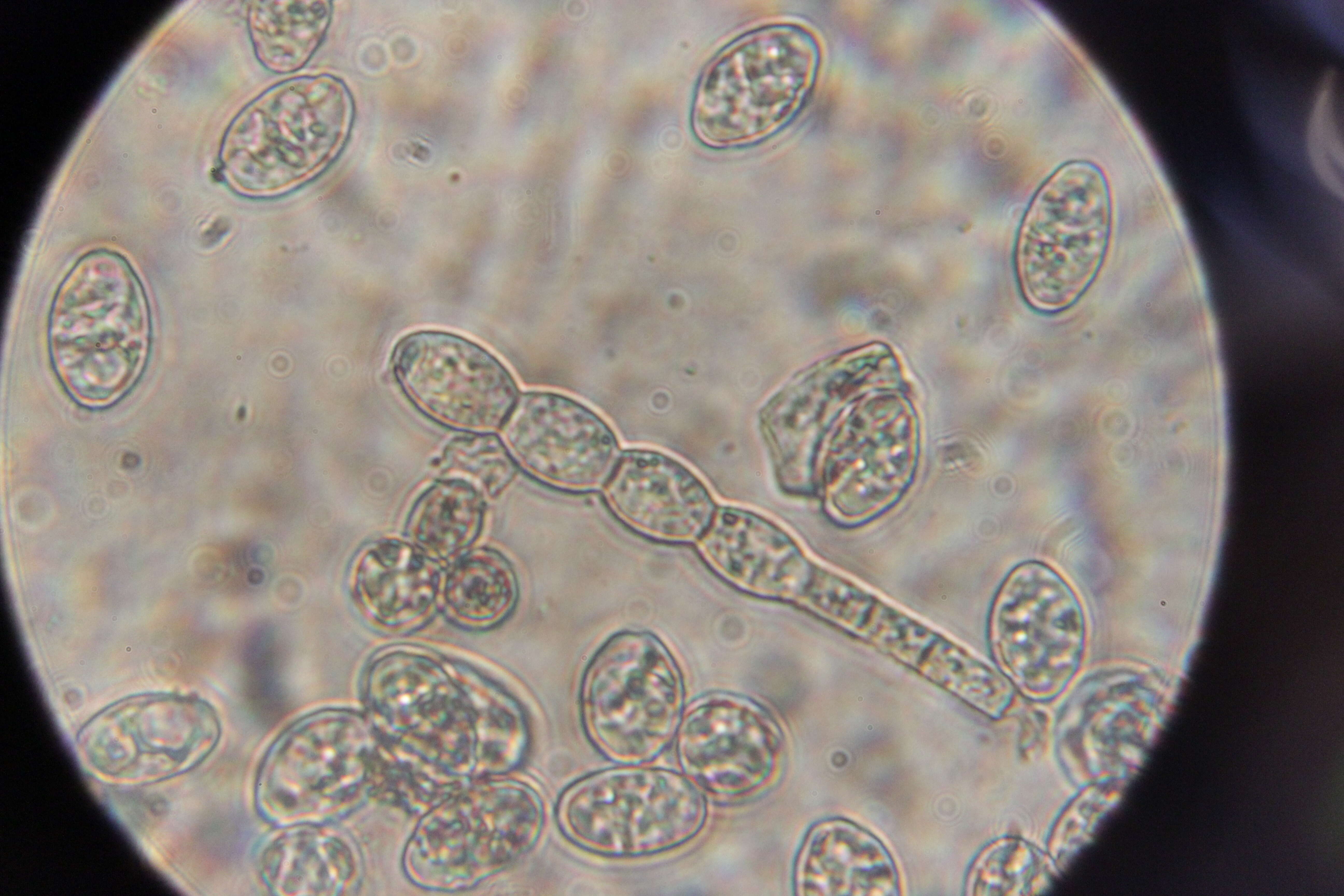 Podosphaera filipendulae (Z. Y. Zhao) T. Z. Liu & U. Braun 2010的圖片