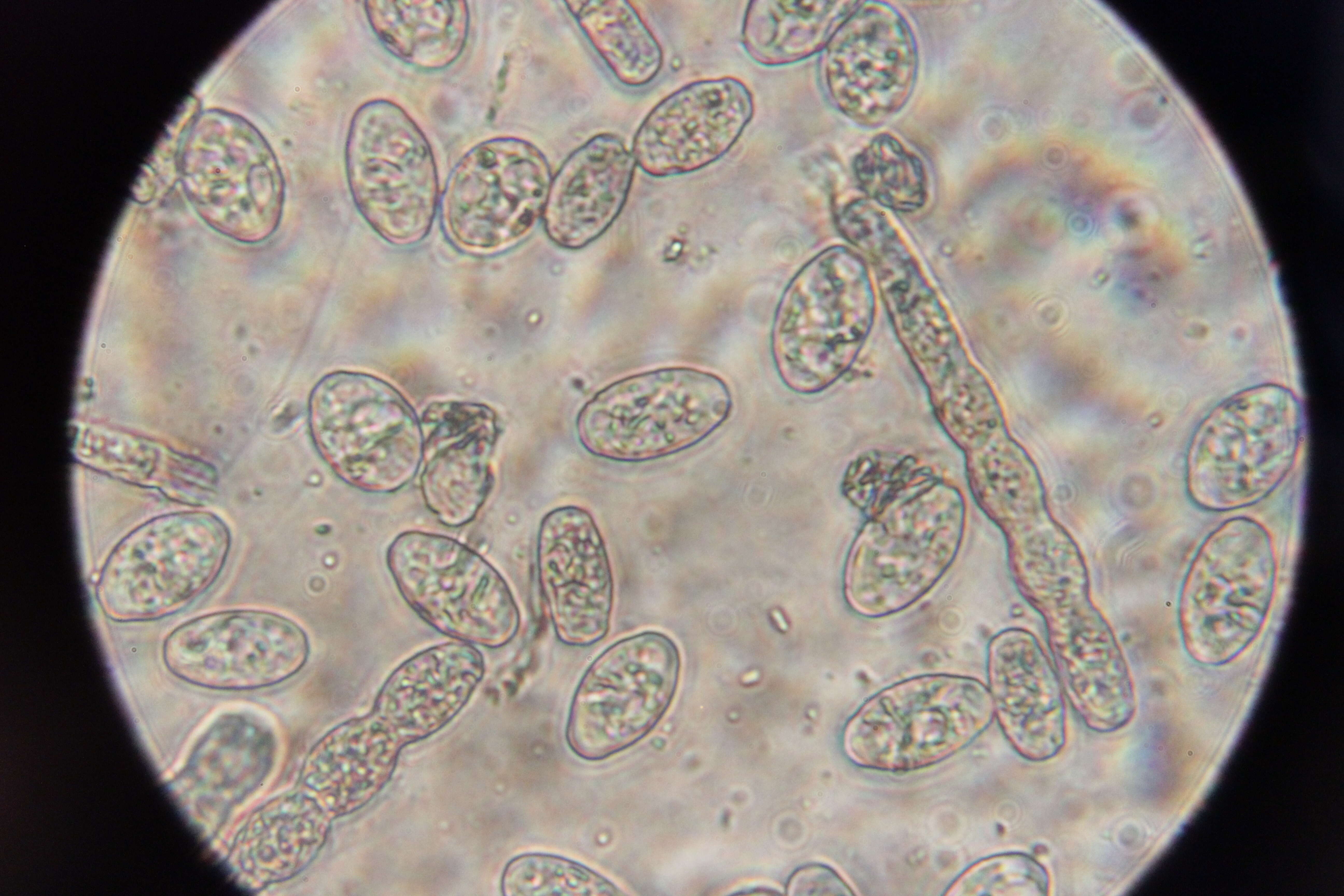 Podosphaera filipendulae (Z. Y. Zhao) T. Z. Liu & U. Braun 2010的圖片