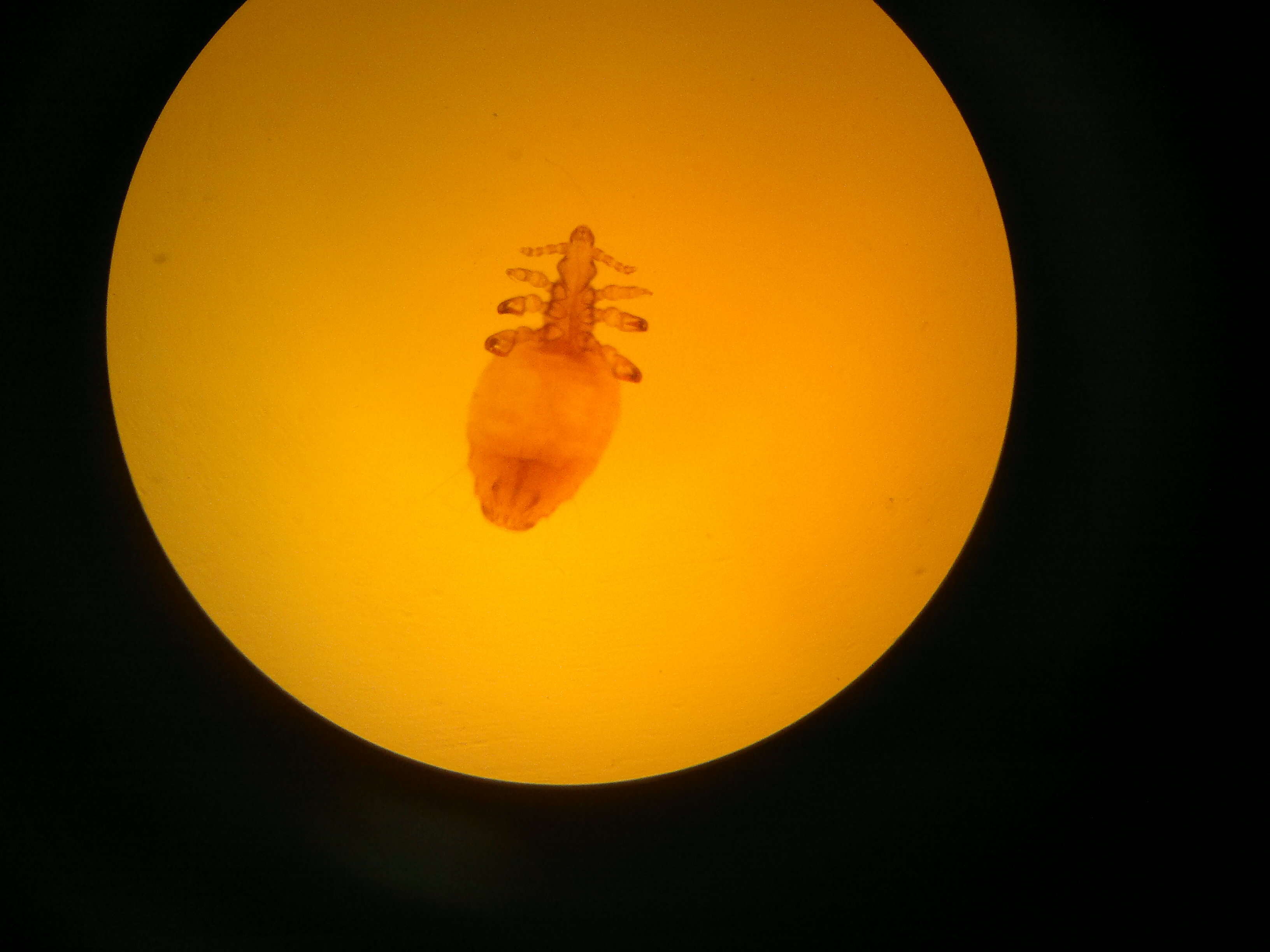 Image of Body Louse