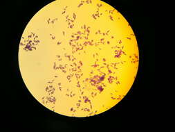 Image de Toxoplasma