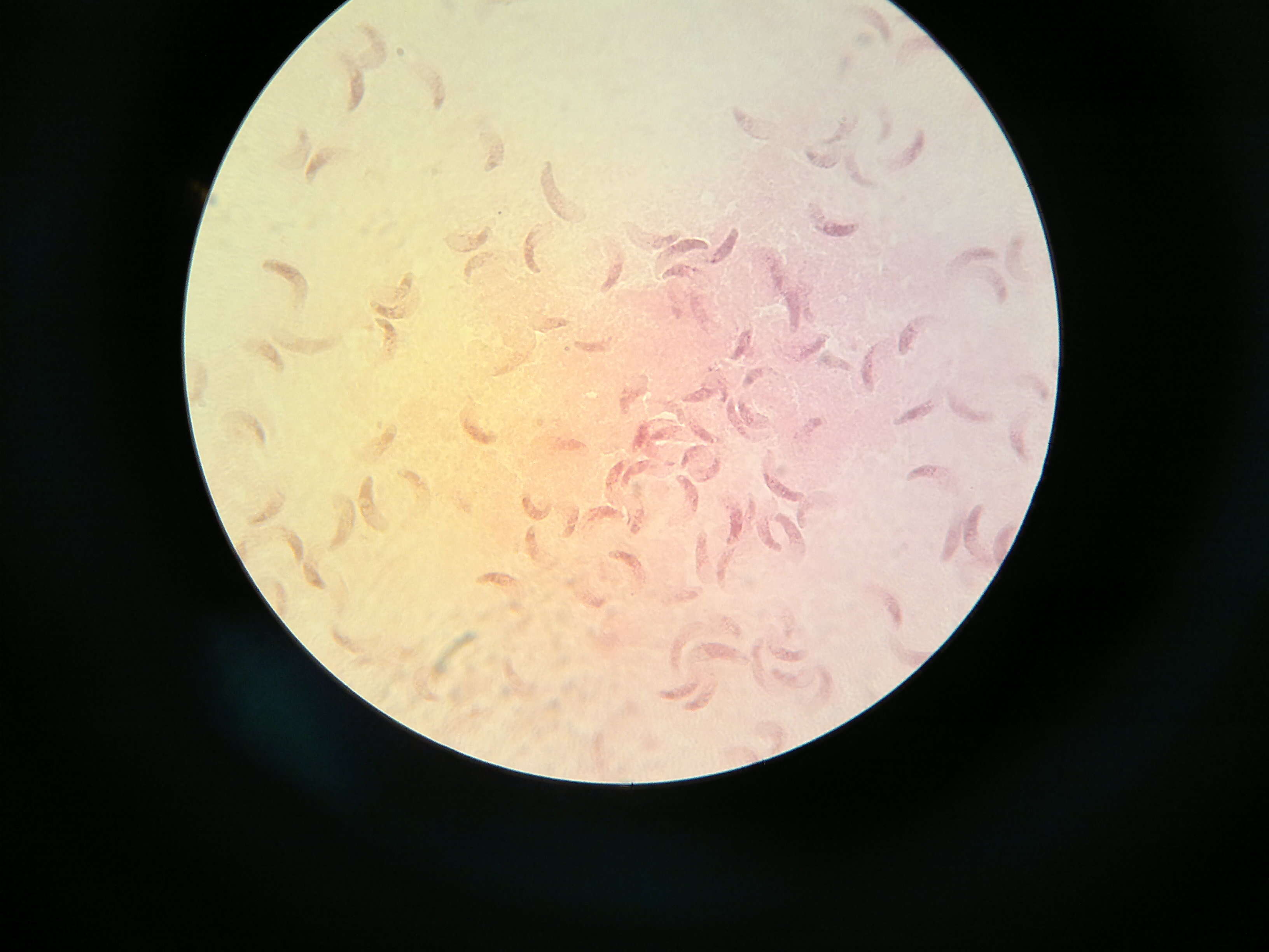 Image de Sarcocystis