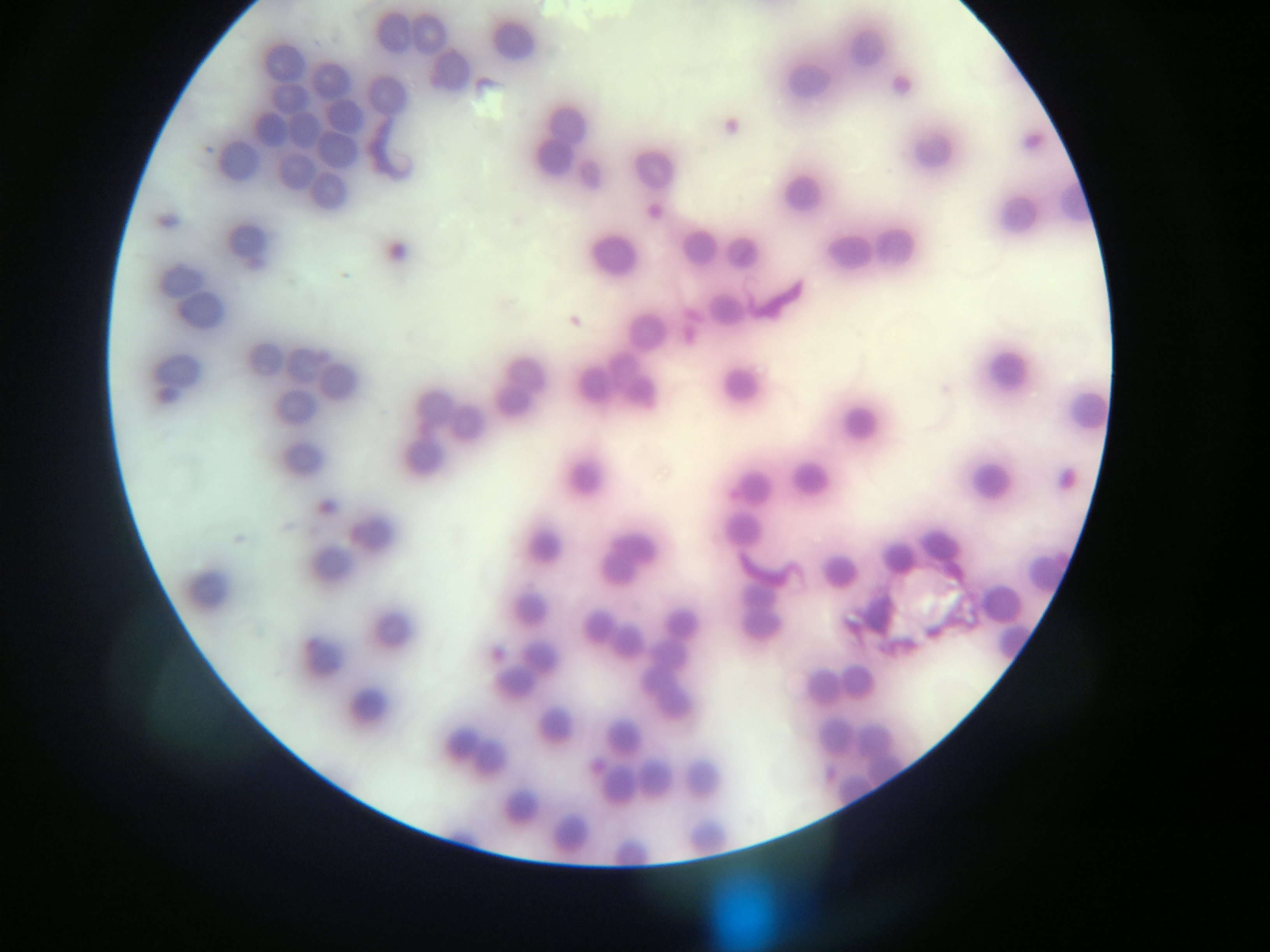 Image de Trypanosoma subgen. Schizotrypanum