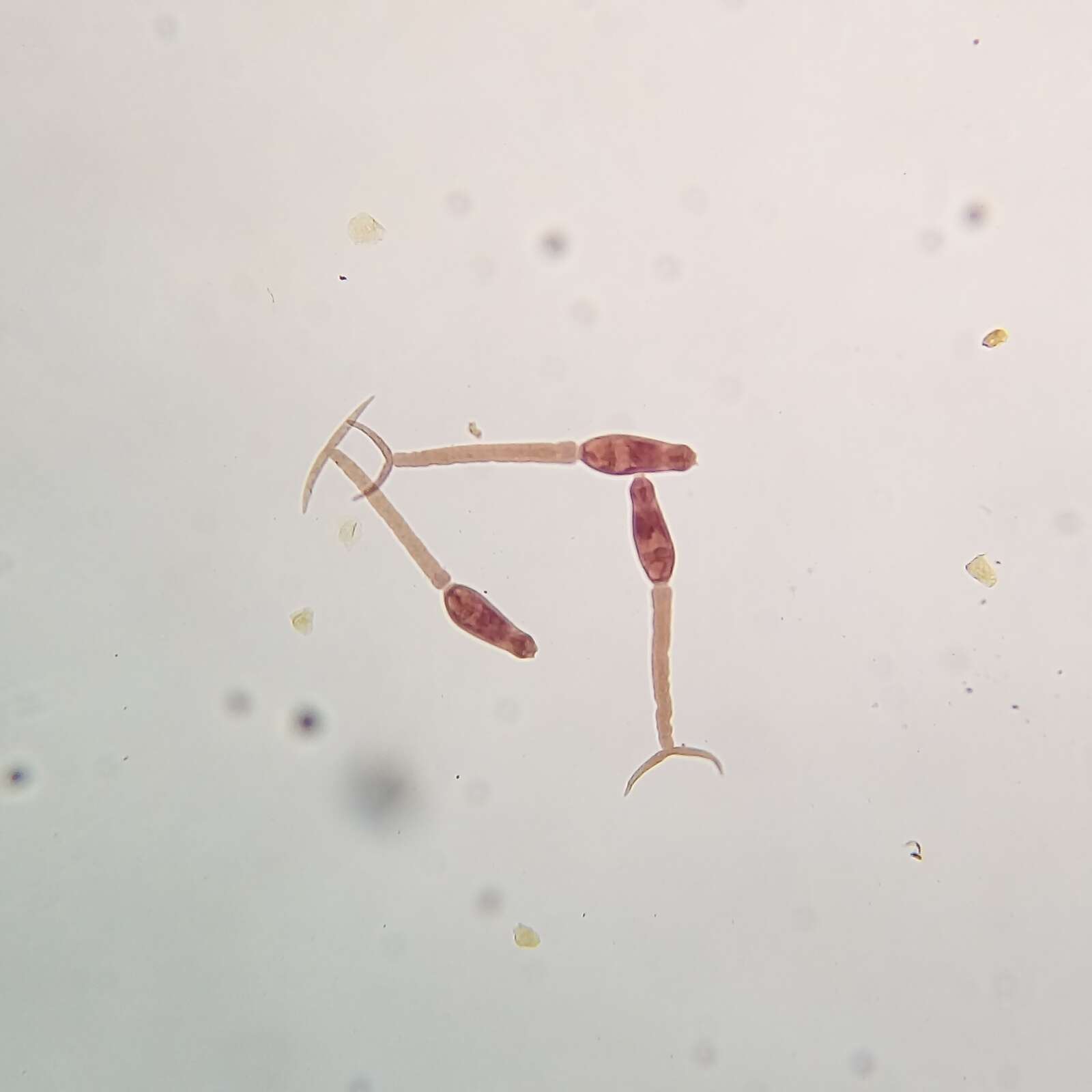 Image of Schistosoma mansoni