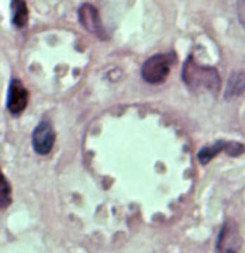 Image of Leishmania mexicana