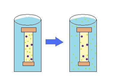 Imagem de Dialysis