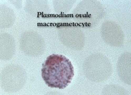 Image of Plasmodium ovale