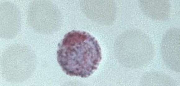 Image of Plasmodium ovale