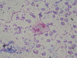 Слика од Pseudomonas aeruginosa