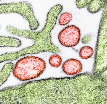 Image of Nipah virus