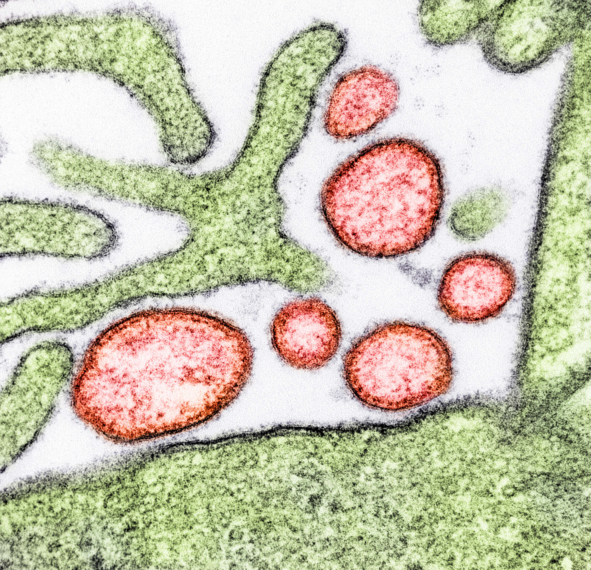 Image of Nipah virus