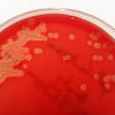 Image of Gallibacterium