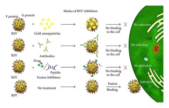 Image of Human respiratory syncytial virus