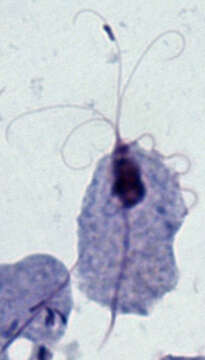 Image of Trichomonas vaginalis