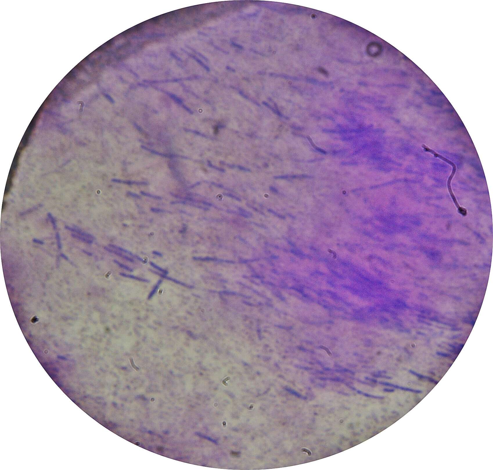 Image of Bacillus thuringiensis