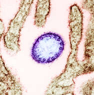 Image of Nipah virus