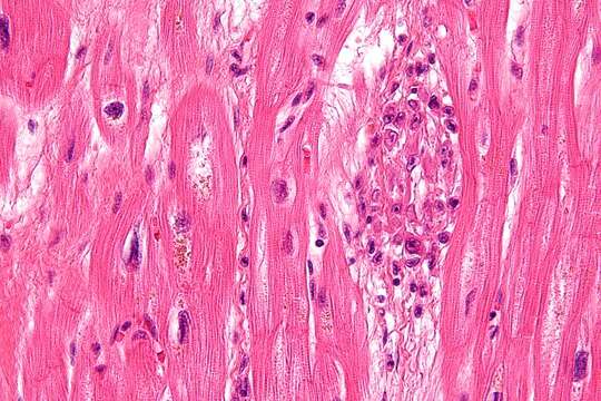 Image of Streptococcus pyogenes