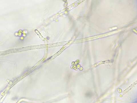 Image of Aphanomyces de Bary 1860