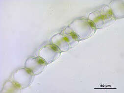 Image of papillose sphagnum