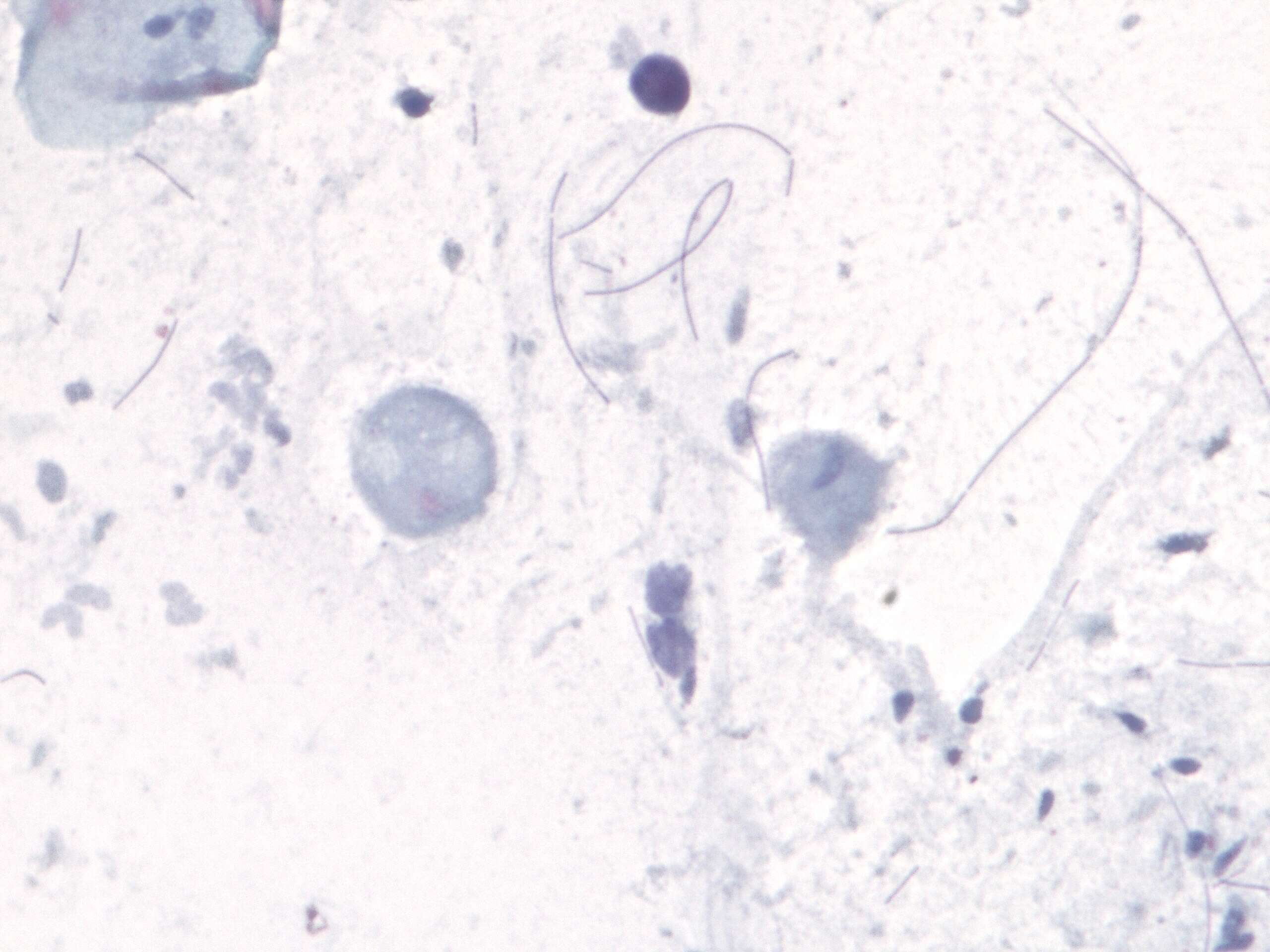 Image of Trichomonas vaginalis