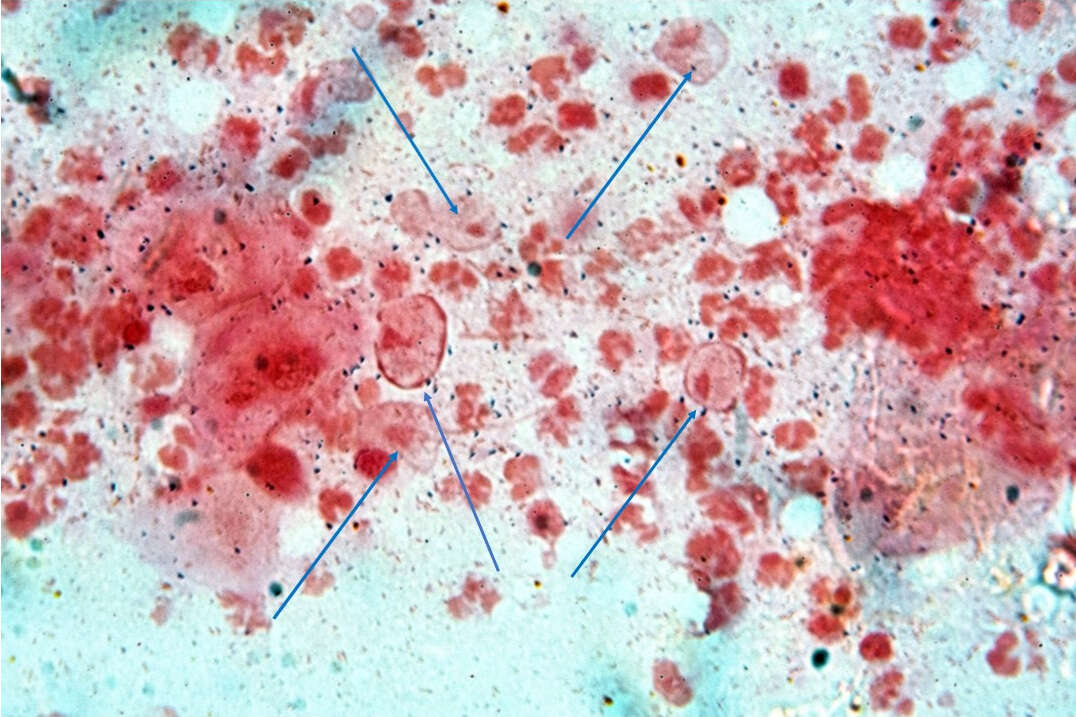 Image of Trichomonas vaginalis