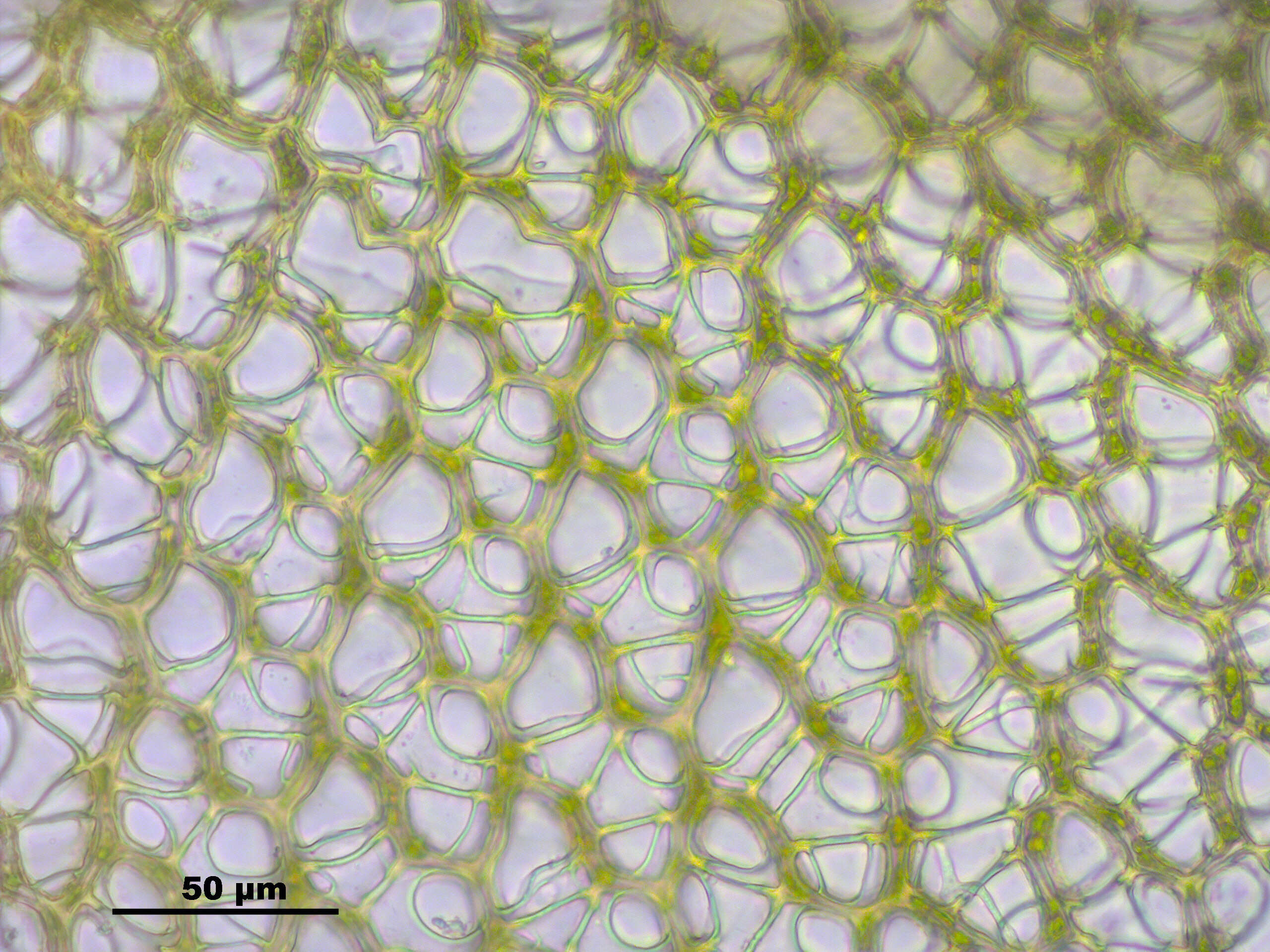 Image of papillose sphagnum