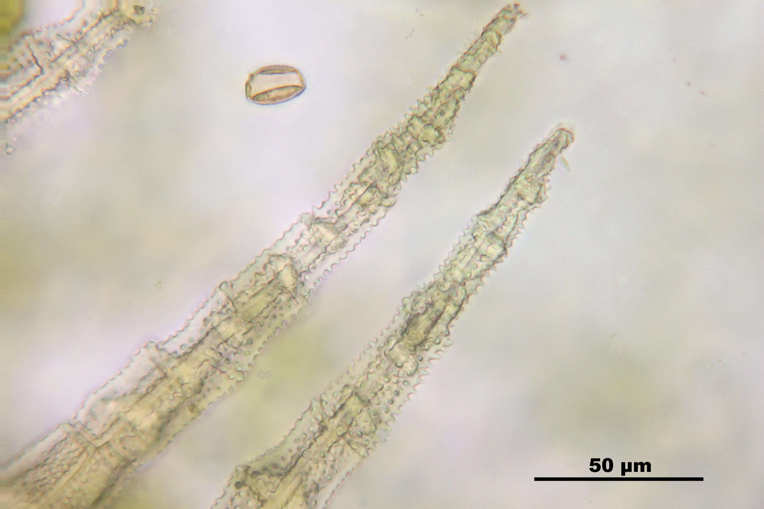 Image of hylocomiastrum moss