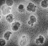 Image of Plasmavirus