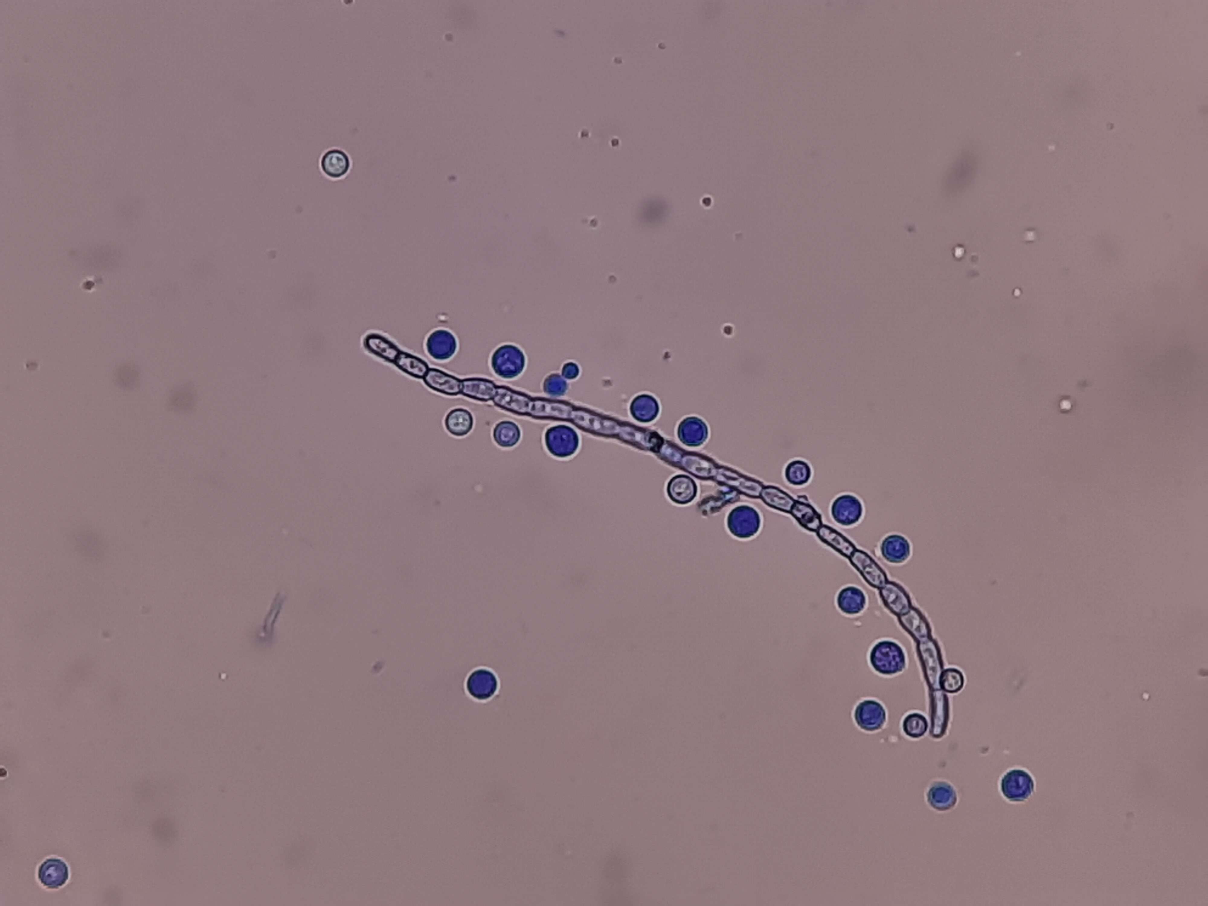 Image de Cryptococcus
