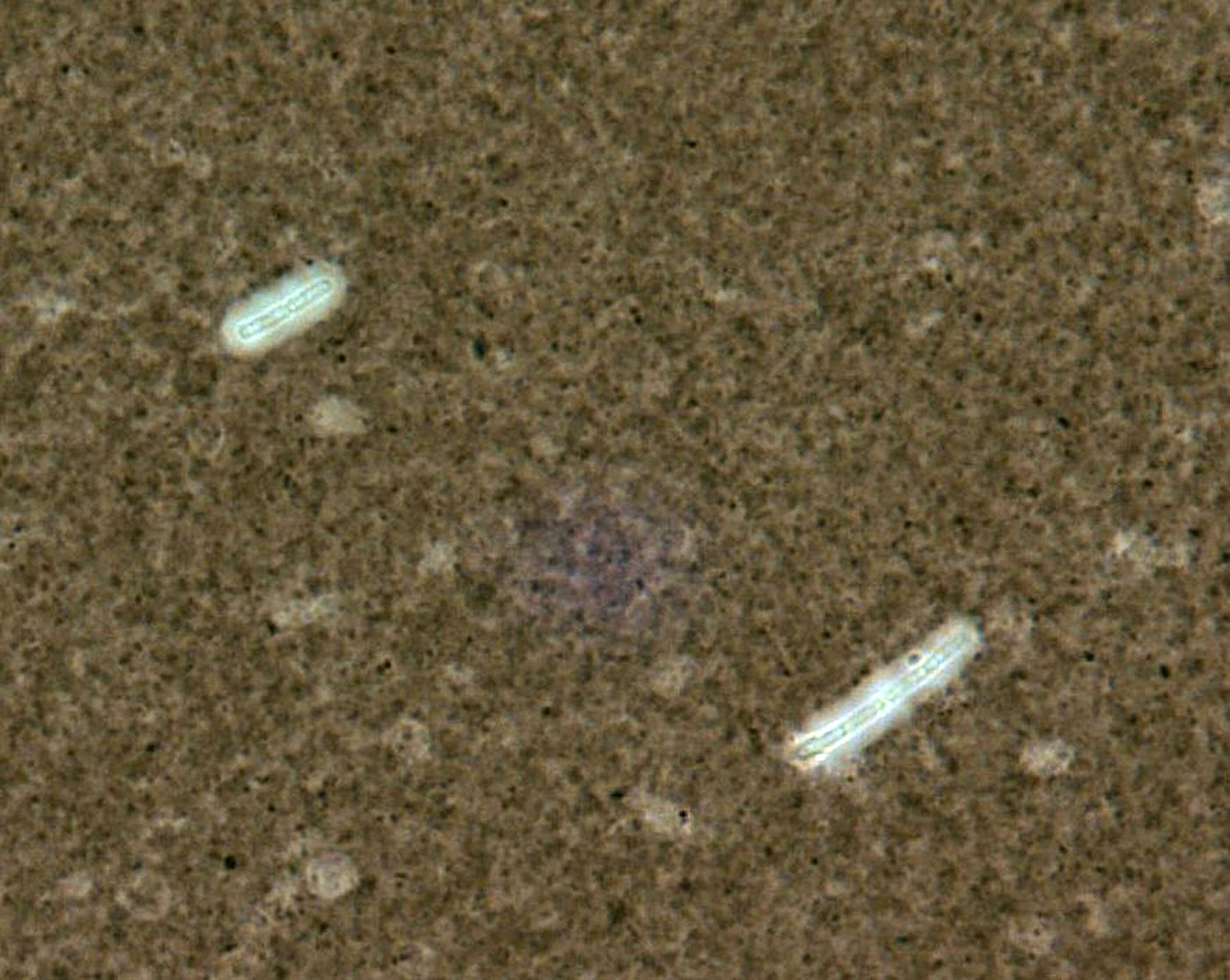 Image de Bacillus anthracis