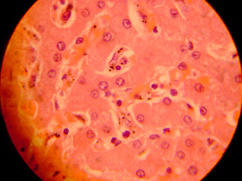 Image of Plasmodium subgen. Plasmodium