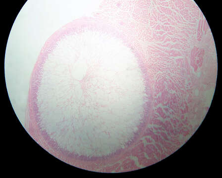 Image of Sarcocystis
