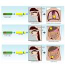 صورة Human herpesvirus 4