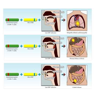 Imagem de Human herpesvirus 4