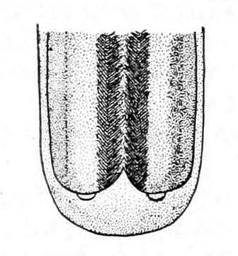 Image of Capillaria