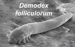 Imagem de Demodex folliculorum Simon 1842