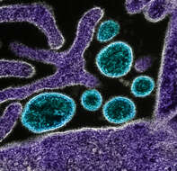 Image of Nipah virus