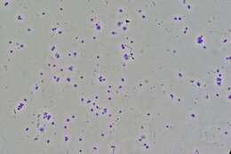 Image of Toxoplasma