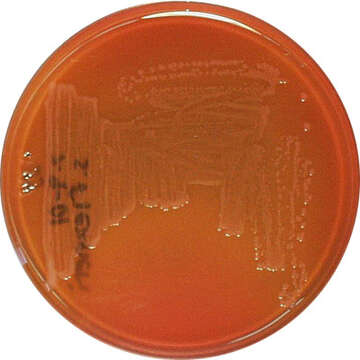 Image of Shigella dysenteriae