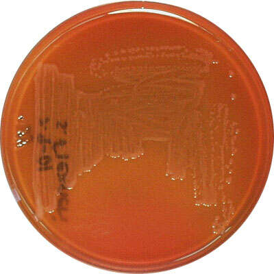 Image of Shigella dysenteriae