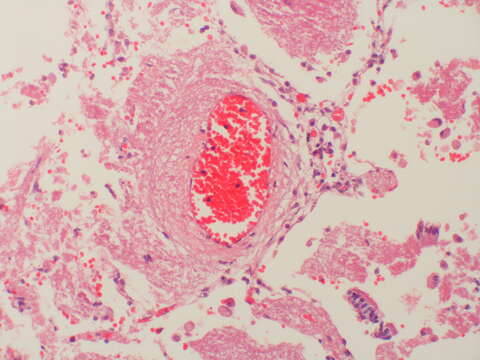 Image of Pneumocystomycetes