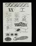 Image of Spirogyra Link 1820